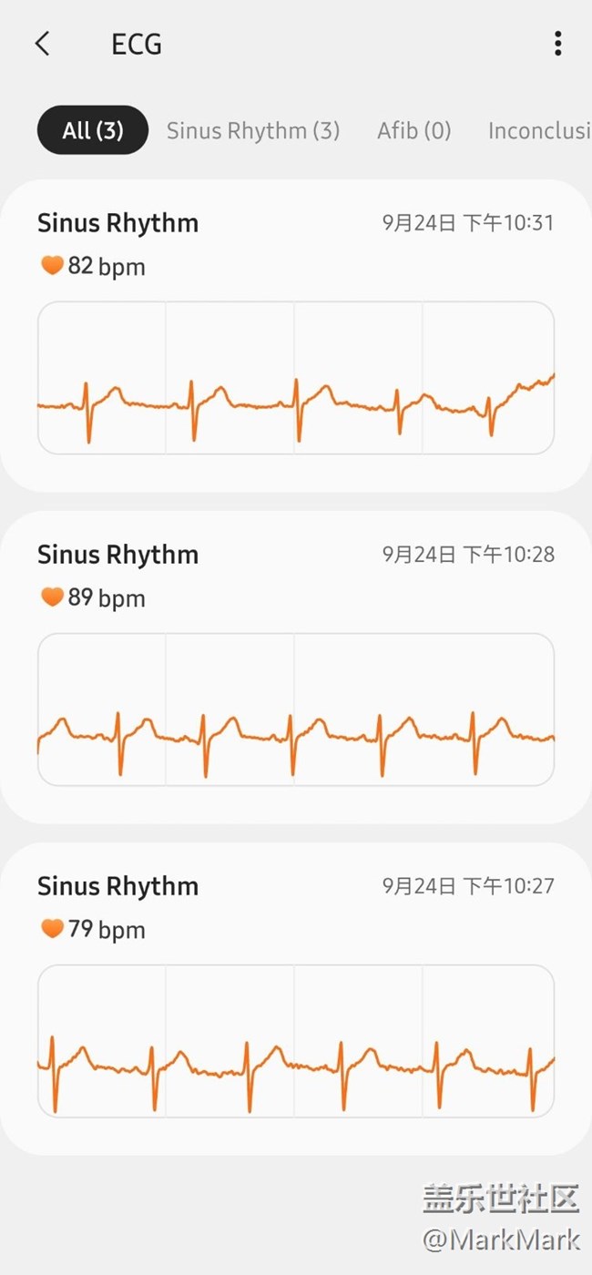 终于ECG