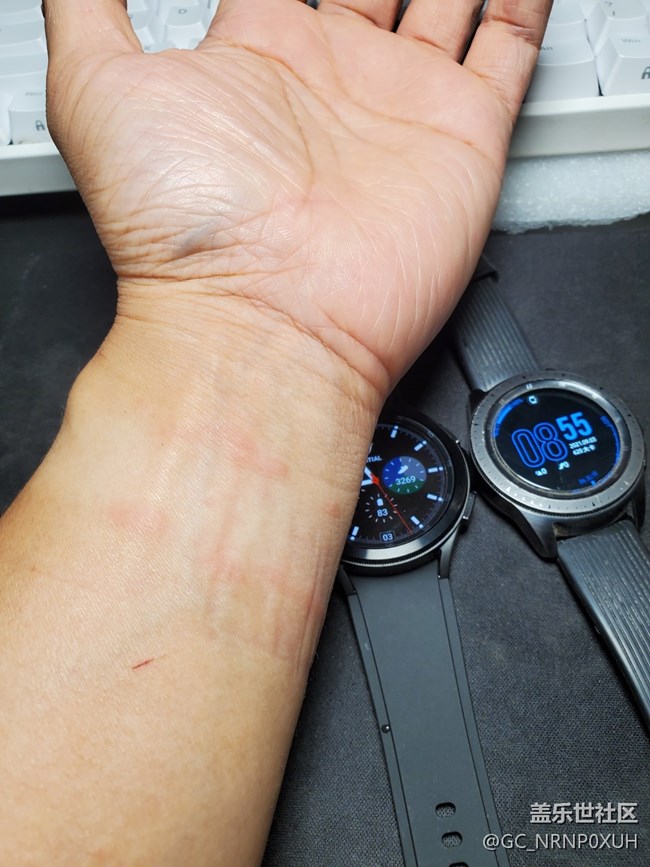 Galaxy Watch4表带有疑似过敏现象