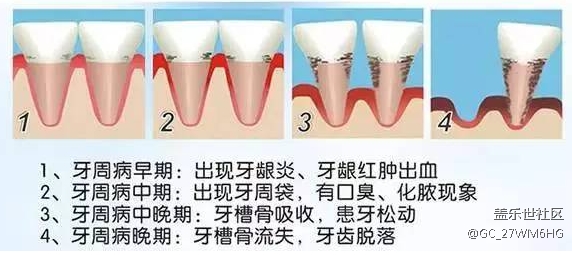 电动牙刷的危害副作用科普：护理邓琪四类坑货别买！
