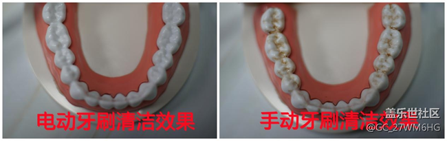 电动牙刷怎么选？四类伤牙坑货危害深远！