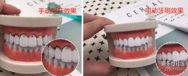 电动牙刷好不好用？盘点三大危害隐患，再不踩雷！