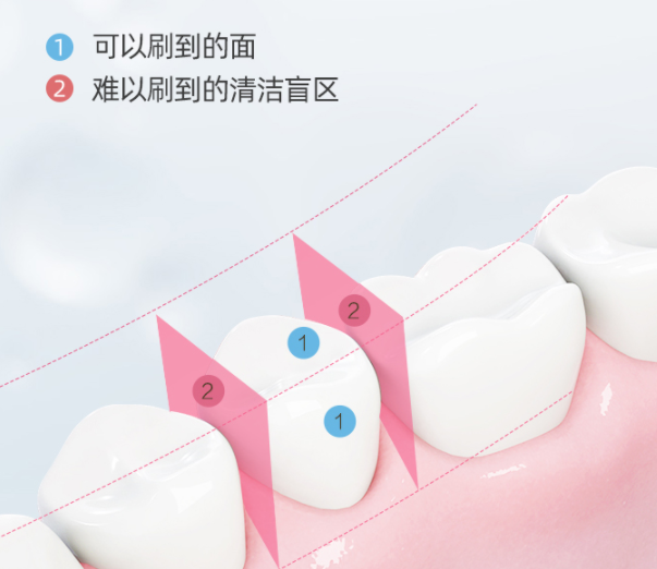冲牙器到底好不好？资深个护讲解三大伤牙危害