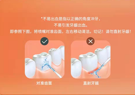 冲牙器的危害弊端有哪些？这三类人群千万当心