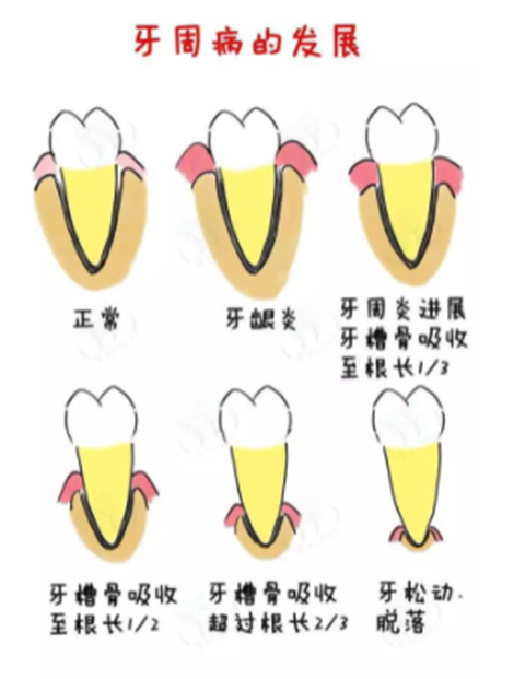 哪些人不适合电动牙刷？五类特殊人群慎用!