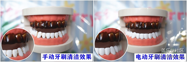 电动牙刷的优点与缺点科普，小心三大弊端！