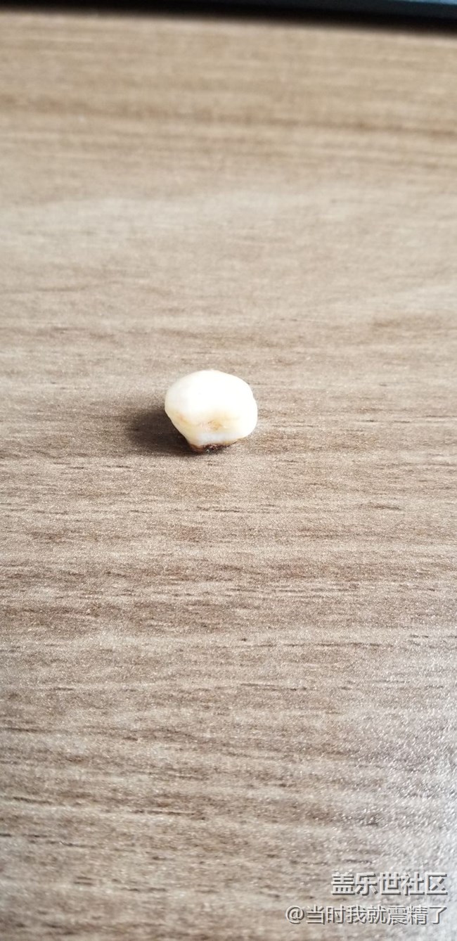 拔了一颗智齿，大图伺候~