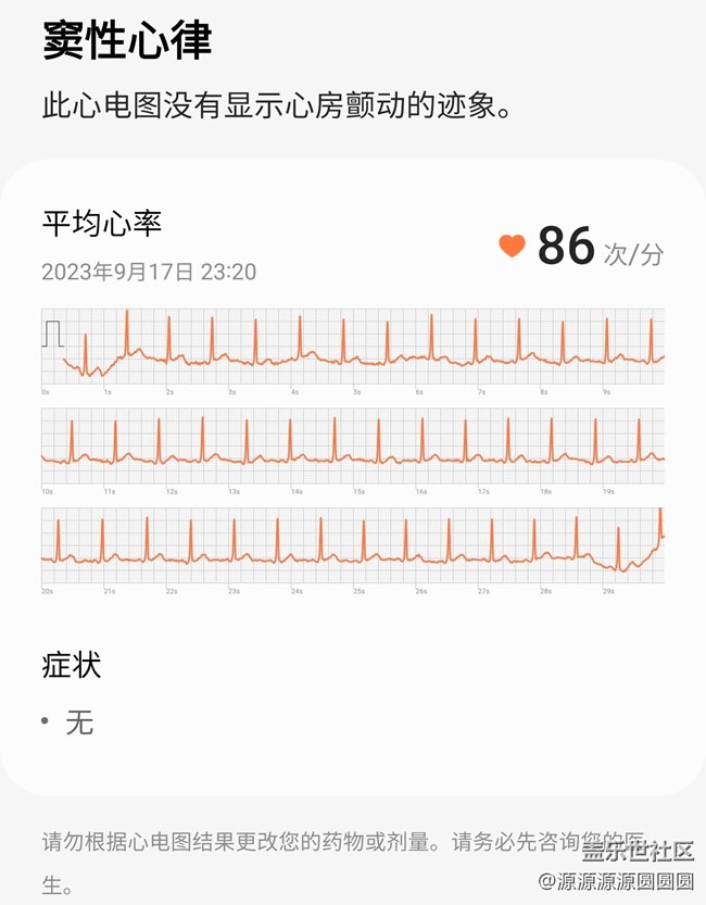 三星GALAXY Watch One ui 5初体验