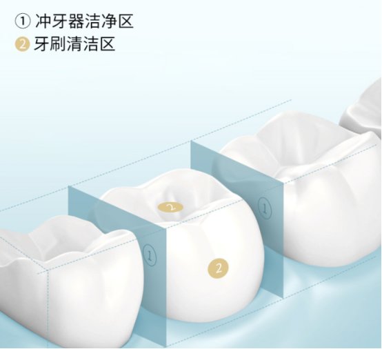 冲牙器有什么副作用？谨防四大危害风险！