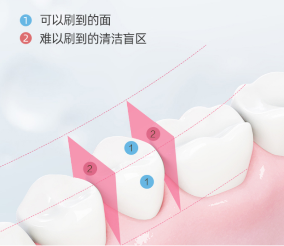 冲牙器对牙龈好吗？警惕三大危害槽点！